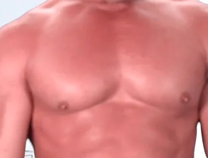 Be My Dental Patient and Pretend to Be Kyle