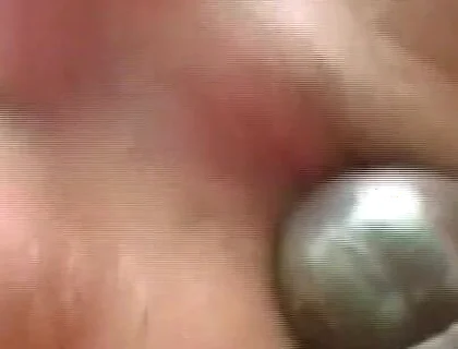 Gaping Anal Rosebud Prolapsing After Deep Stretching Session