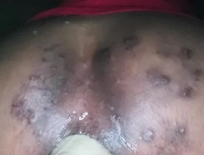 Up and Personal with the Thrashy Ass of a CD