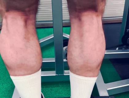 My Legs