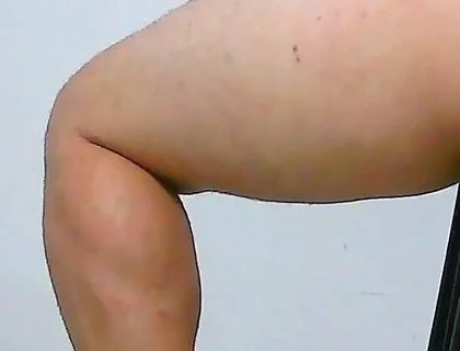 Oh, My Ass Hurts, Apply Ointment