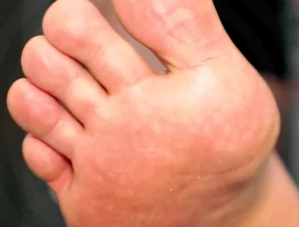Golden Foot Bath for Pigs