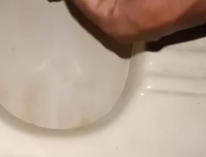 Urinating From the Penis