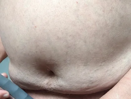 Shave and Suck