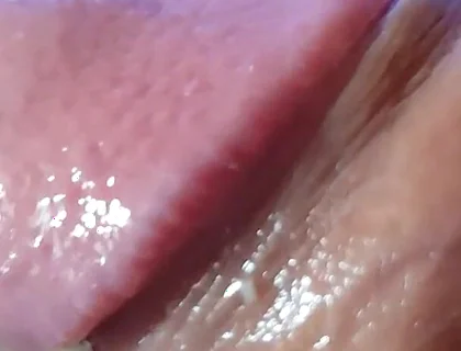 Strange Lumpy Cock with a Gigantic Head.