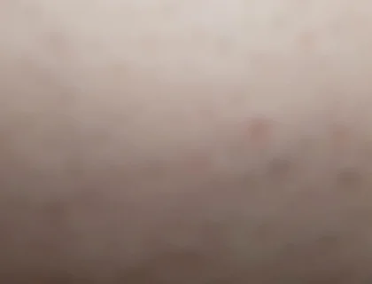 You Suck Me POV
