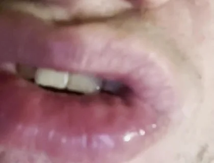 Mad for Tongue