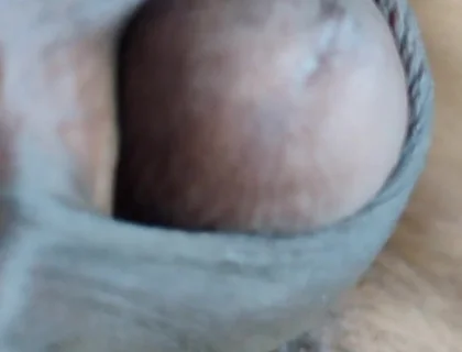 My Penis