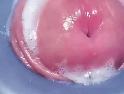 Penis Machine with a New Attachment