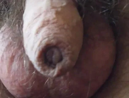My Penis Walkabout