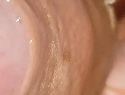 Large Cheese Accumulated in Close up of Glans