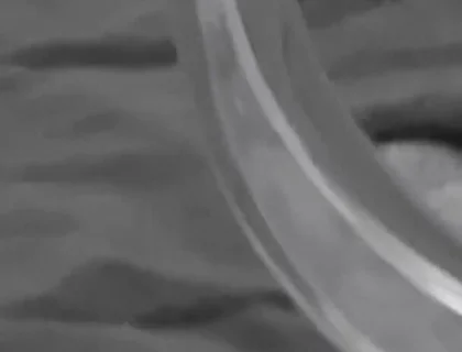 An Anal Compilation of Me