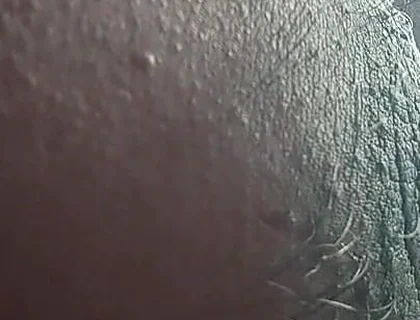 Armpit