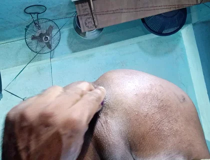 Anal sex