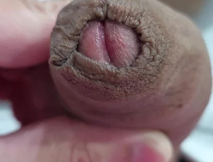 The Head of My Penis