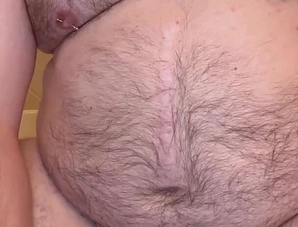 Pierced Chubby Guy Sounding with 3mm - 4mm and 5mm - 6mm Hegar