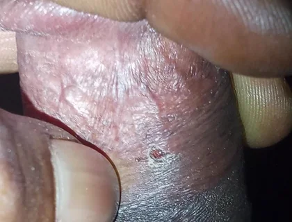 Now Videos