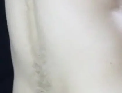 Ass stretching, big toys, inflatable, huge buttplugs, cumshot.