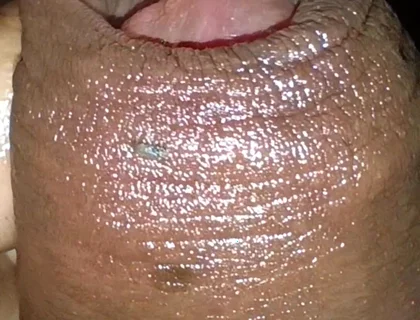 Close-up of Foreskin and Ejaculation in My Pants