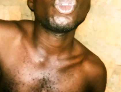 My Great Massaging and Maculation