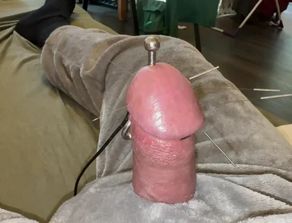 Acorn Acupuncture in a Cozy Cuddly Suit! Lots of Sperm!