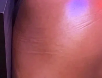 Bubble Butt