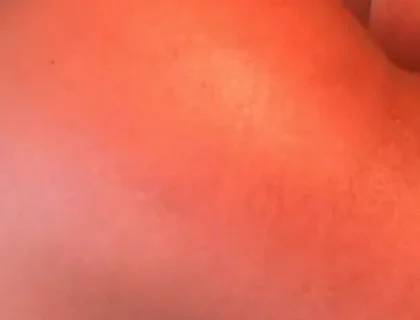 Bubble Butt