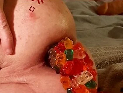 Big Load Of Gummy Bears Anal Stuffing And Expulsion Whit Prolapse