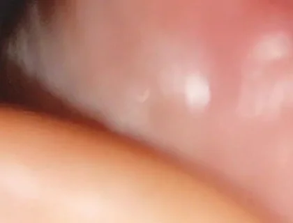 Hot Daddy in Close-up of the Inside of the Glans!