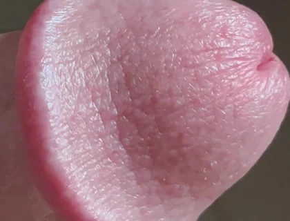 Closeup of Penis with One Vein