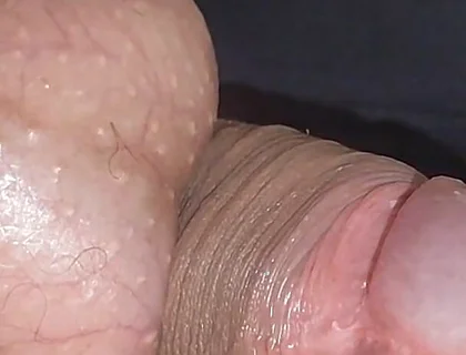 Amazing Upright Rough Venous Frenulum.