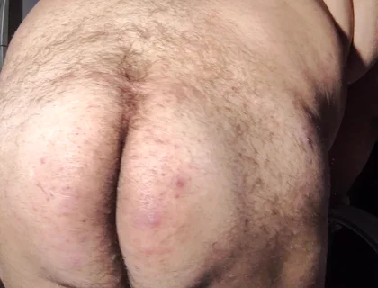 Fat Obese Butt