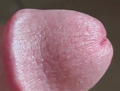 Closeup of Penis with One Vein