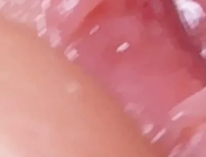 Extreme Dirty Daddy's Widened Hole.
