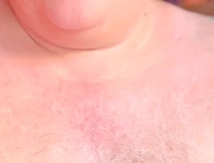 Old Man with Thickest Mushroom Penis