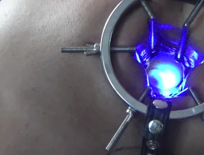 Backdoor Lightshow