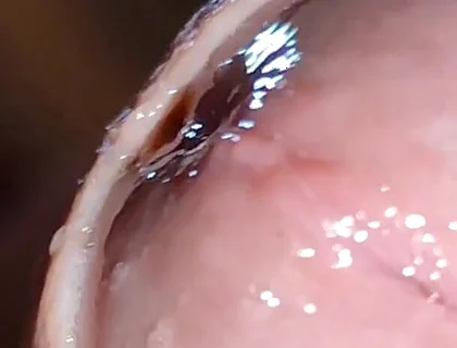 Glans Eye Watering After Intense Fucking.