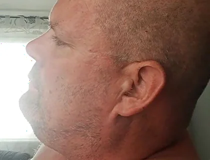 Renewed Destruction of the Bitch