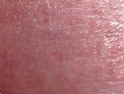 Sperm Close-up Front