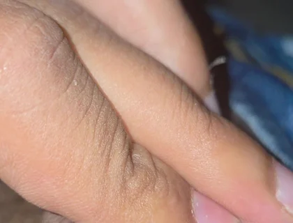Closeup