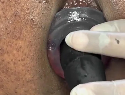Ass Gape