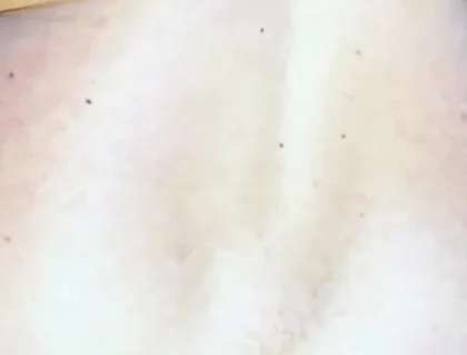 Extreme Anus Gape