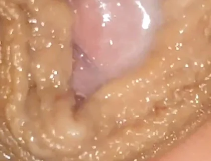 Urethral Fluid in Large Quantities Makes It Slippery.
