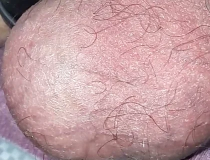 My Balls in POV