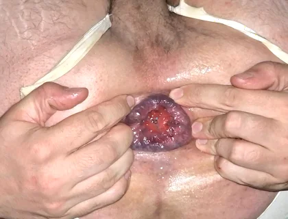 Young Sissy's Gaped Asshole Is Ready for Fisting
