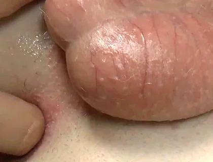 Stick Your Fingers in Casper's Butt