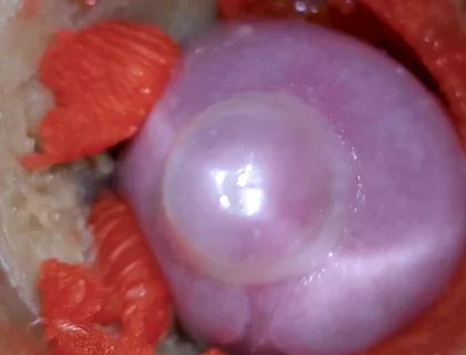 The Camera Inside the Deep Pussy Records a Huge Ejaculation with a Stuck Condom 4K