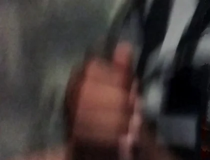 My Hand Exploded When Exposed to Masturbation