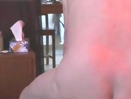 Fisting