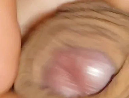 The World's Largest Foreskin Opening and Closing.